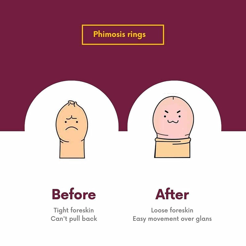 Fore-Stretch Rings (20-Piece-Set) with Cold-Pressed Coconut Oil and 'How to