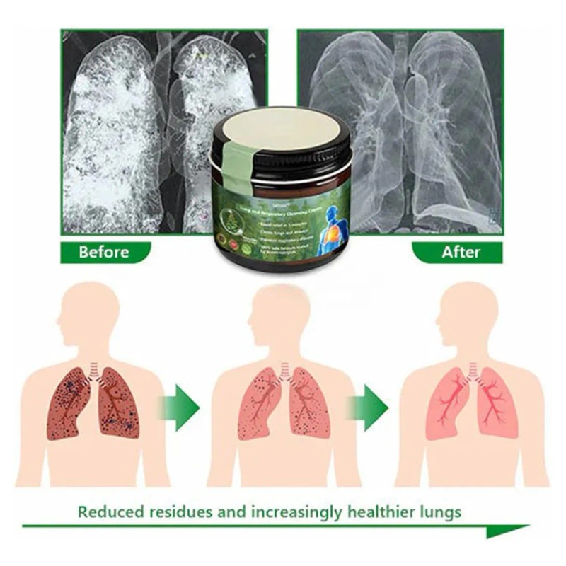 Crema Pulmonar Transparente De 2 Piezas Para Mejorar La Salu