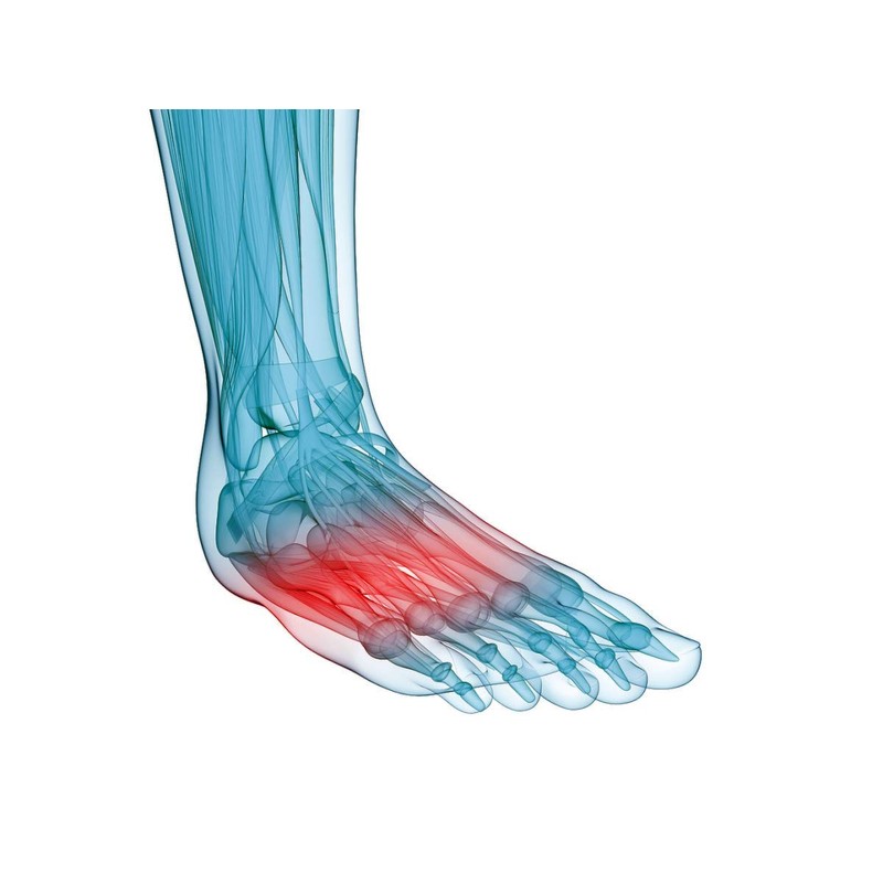 SoleM8 Full Length Orthotic Insole with Metatarsal Dome (7.5-7)