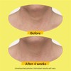 StriVectin TL Advanced™ Tightening Neck Cream Plus, 1.7 oz for