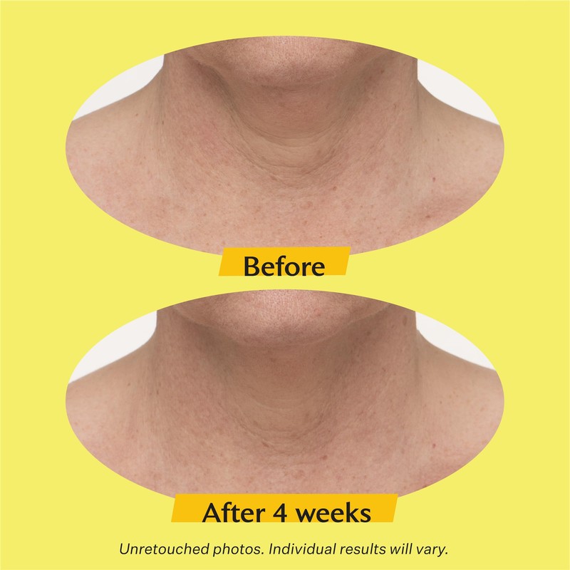 StriVectin TL Advanced™ Tightening Neck Cream Plus, 1.7 oz for