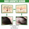 30ml 4PCS Ginger Hair Growth Spray Nutritious Moisturizing Hair Root