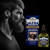 about the condition Aceite Para Hacer Crecer La Barba Y