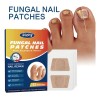 32pz Parches Antimicóticos For El Tratamiento De Uñas