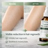 Adweekey Cyperus Rotundus Hair Removal Spray, 2 fl oz