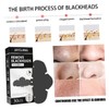 FOMIYES Purifying Nose Masks Sheets Blackhead Removers for Oily Skin