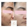 Crema Para El Rostro La Favorita