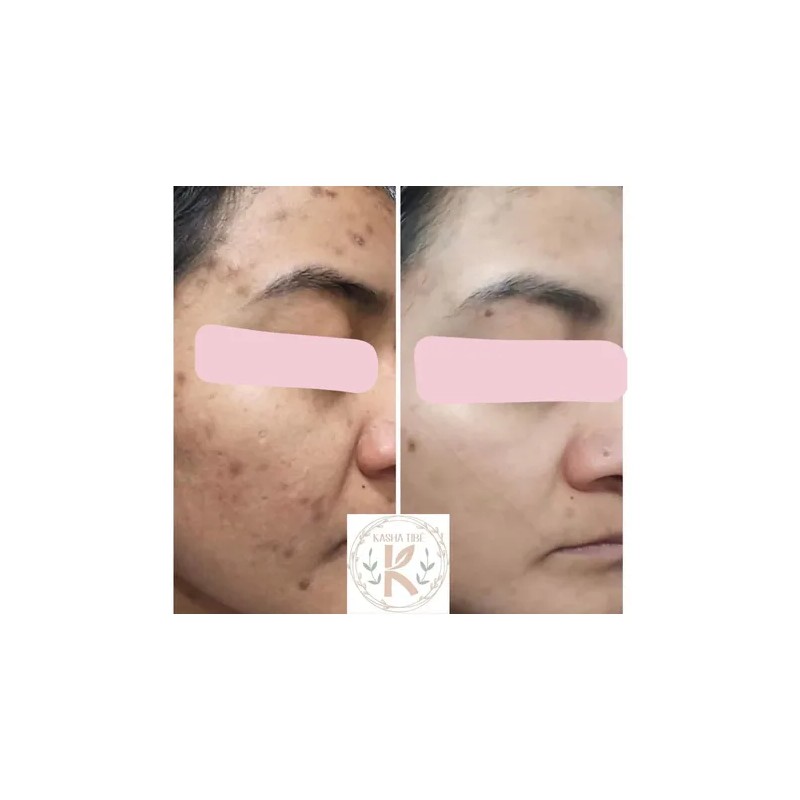 Crema Para El Rostro La Favorita