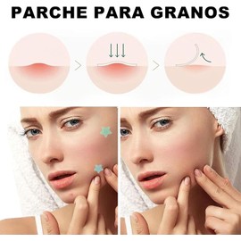 Parches para Acné, 316 Parche Maestro para el Acné, Parches de Estrellas, Hidrocoloides, Reduce Visiblemente Las Immperfecciones Granos y Espinillas, Pueden Absorber la Secreción, para Todos Los Tipos de Piel