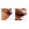 Crema Para Reducir Papada Tonificar Cuello Adelgaza Reafirma Fresh