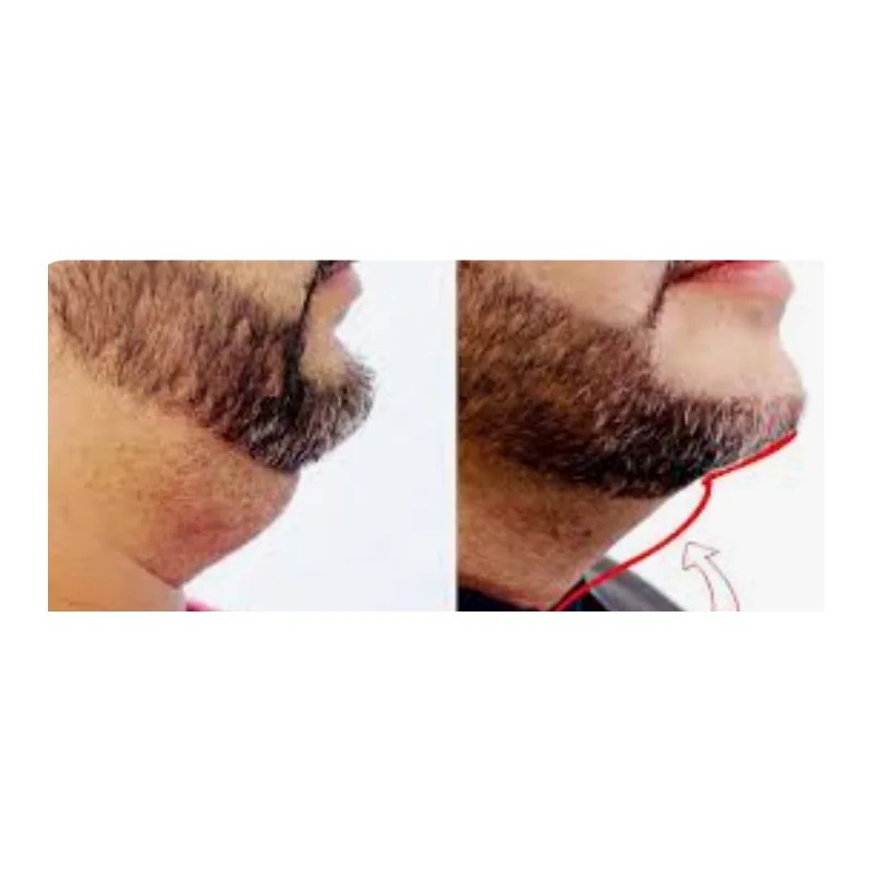 Crema Para Reducir Papada Tonificar Cuello Adelgaza Reafirma Fresh
