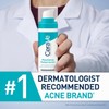 CeraVe Resurfacing Retinol Serum For Post Acne Marks, Formulated With