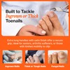 Fox Medical Equipment Toenail Clippers for Thick Nails, Medical Grade