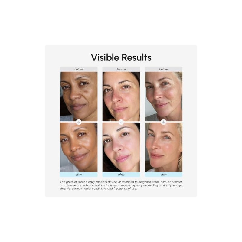 Maree Crema Hidratante Facial Retinol Rostro Antienvejecimiento Colágeno