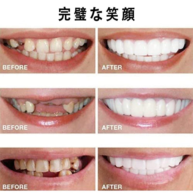2 Pairs of Dentures Dentures, Dentures, Make Your Own Temporary