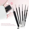 Kit De Herramientas Para Eliminar Espinillas Y Puntos Negros