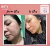 BTY Over Night Mask Best Seller Ready To Ship ‼️
