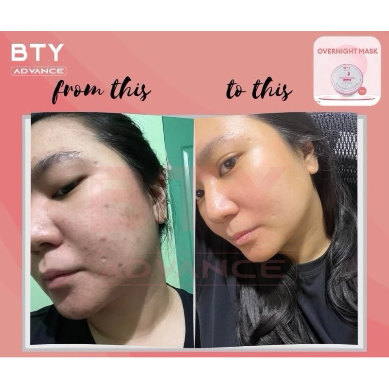 BTY Over Night Mask Best Seller Ready To Ship ‼️