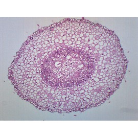 EISCO (Pack of 10) Zea Mays Root Tip, Cross Section - Prepared Microscope Slides - Classroom Pack, 10 Slides in Storage Case - Biology & Microscopy