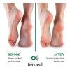 Tratamiento Antihongos Terrasil® Max 1.7oz