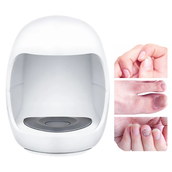 Unbranded Toenail Fungus Treatment Nail Fungus Laser Treatment Device For