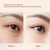 Eyes RF Radio EMS Microcurrent Black Eye Radio Frequency Machine