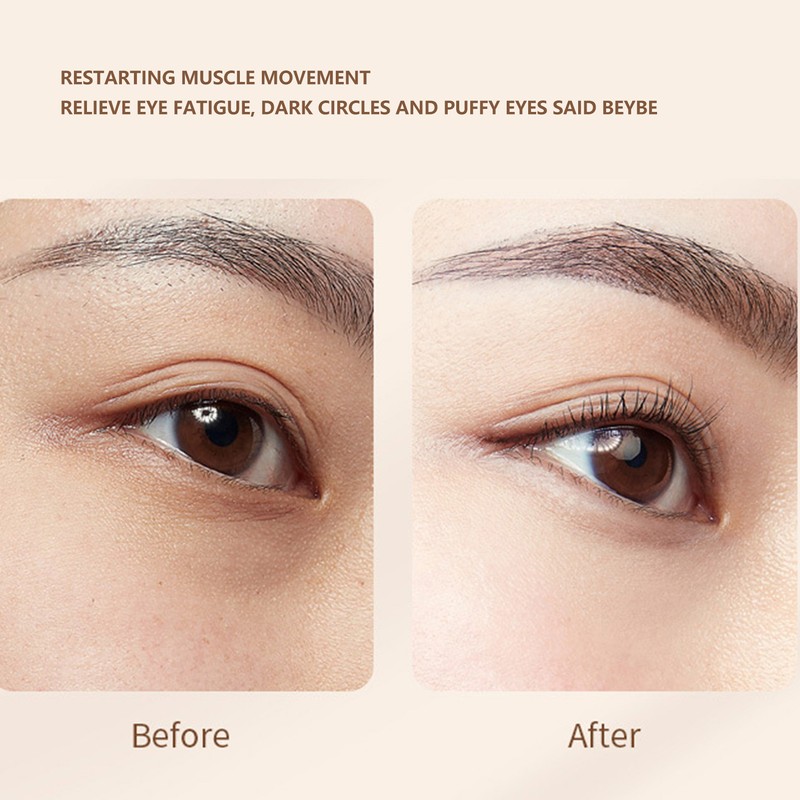 Eyes RF Radio EMS Microcurrent Black Eye Radio Frequency Machine