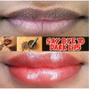 Sale!! Remove Dark Lip Balm Lighten Melanin Keeping Elasticlip Mask