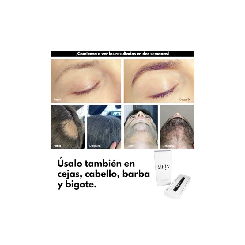 Tonic Mein x MLashes, serum para hacer crecer las pestañas