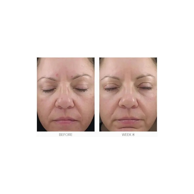 Obagi Medical Obagi 360 Crema Con Retinol 0.5 28g