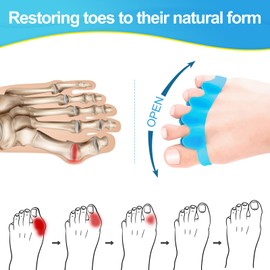 8 PCS Professional Toe Separators. Juzure Silicone Toe Spacers to Correct Bunions and Restore Toes to Their Original Shape for Women Men. Toe Correctors/Toe Straightener/Toe Stretcher/Toe Spacers