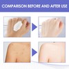 Crema Aclaradora de Partes Intimas de Axilas, Crema para Manchas