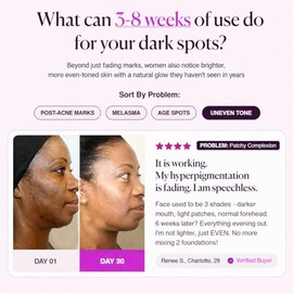 Crema iluminadora, arbutina y crema facial de ácido tranexámico para el tono de piel desigual y el cuidado de la apariencia de las manchas oscuras par