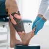 MedEduQuest Burn Wound Packing Trainer, Burn Wound Care Model, Severe