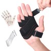 DrFinger Finger Ulnar Deviation Splint Brace, Finger Joint Deviation Orthopedic