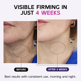 Firming Neck Cream with Retinol, AH-8 Hexapeptide Collage, Firm Sagging Skin on the Neck and Décolleté, Promote Skin repair, Neck Firming Cream with Massage Roller, Value Size 4.3 fl oz