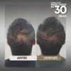 Shampoo De Cabello Graso Tonico Vittale Limpieza Restaurador