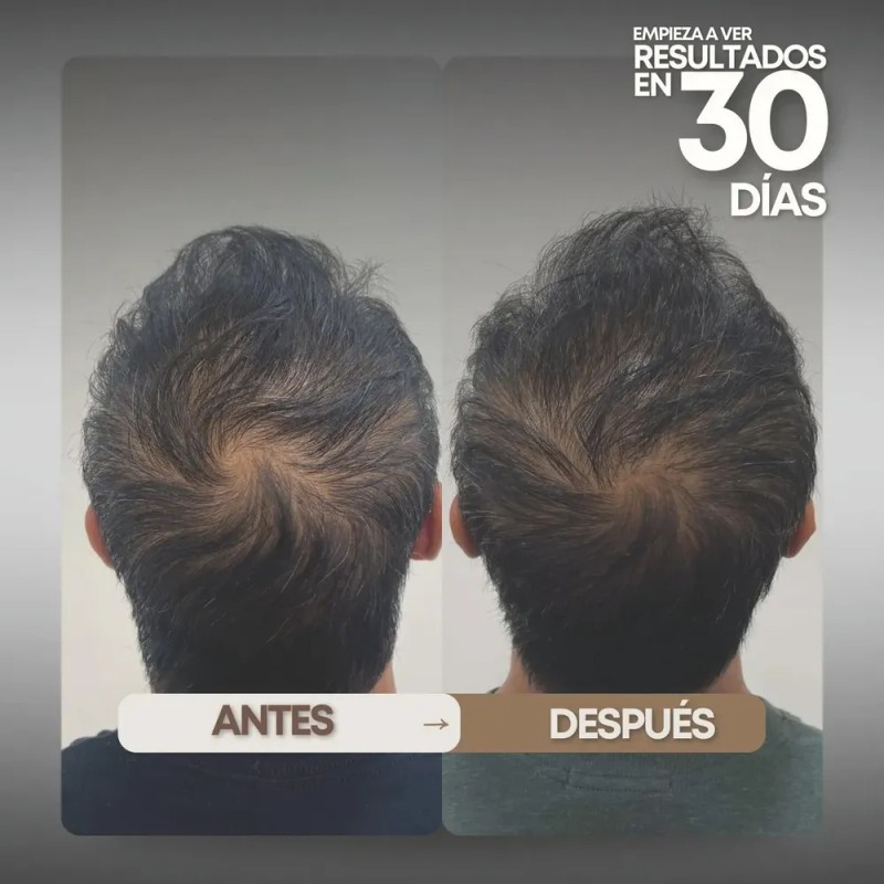 Shampoo De Cabello Graso Tonico Vittale Limpieza Restaurador