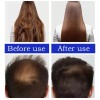 . 2 × Esencia For El Crecimiento Del Cabello, Aceite