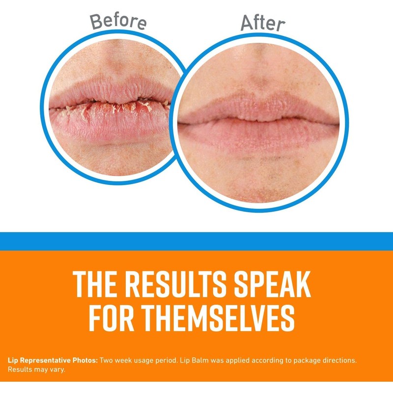 O'Keeffe's Lip Repair No Scent Lip Balm 0.15 oz. 1