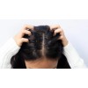Shampoo Adiós Caspa + Ajo/ Seborrea Resequedad Cabello Graso