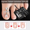 7pcs Ingrown Toenail Correction Tools Kit Stainless Steel Pedicure Foot