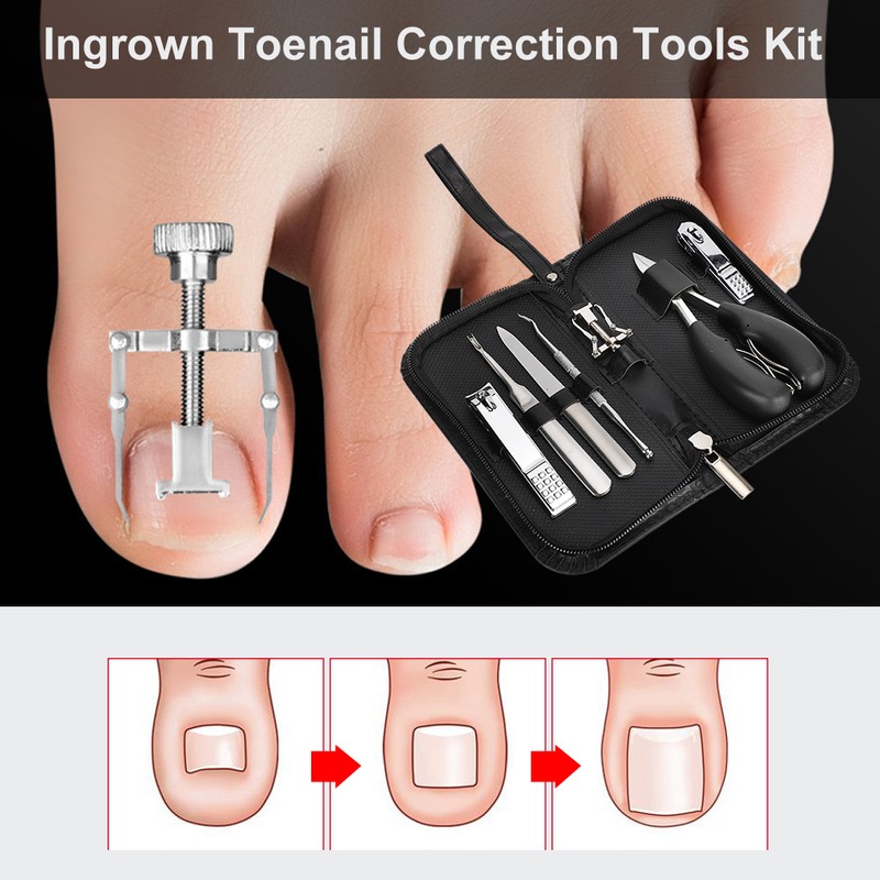 7pcs Ingrown Toenail Correction Tools Kit Stainless Steel Pedicure Foot