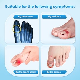 Sylong Broken Big Toe Splint Brace, Big Toe Support for Arthritis, Fracture, Sprains, Injuries, with 2 Stainless Steel Plate - Left (Beige)