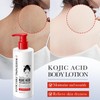 Konololic Acid Light Body Lotion (Red, 1 Piece)