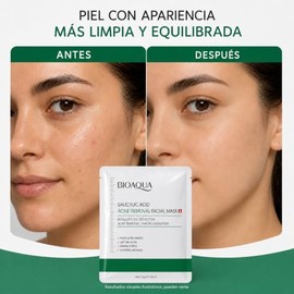 BIOAQUA Mascarilla Facial con Ácido Salicílico, para Acné y Poros, Presentación en Crema, 25 g