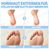 Taliny 2 pieces: 2 in 1 callus remover and nano