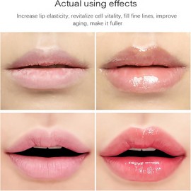 Lip Plumper,Dark Lips Cream,Hydrating and Nourishing Lips Care,Plumping Lip Gloss,Reduce Lip Lines,Lip Boosting Serum,Dark Lips Treatment,Lip Balm for Dry Cracked Lips,Lip Hyperpigmentation Treatment