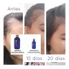 Set Anti Caída Shampoo Y Tratamiento Terramar + Gel
