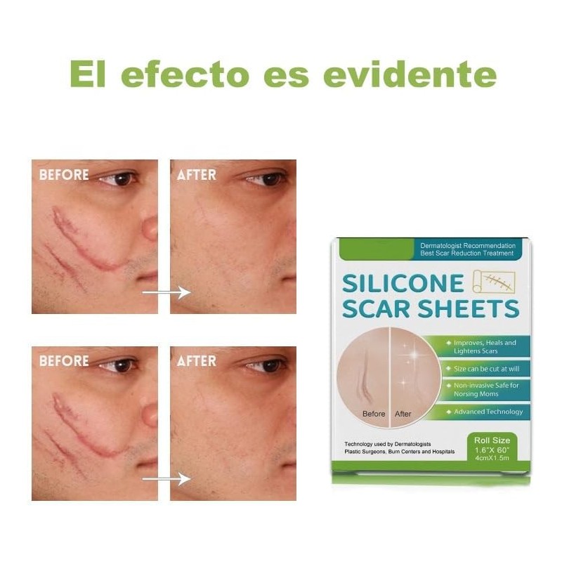 FARSEE Cinta de silicona para cicatrices, aclarante, reutilizable, apta para